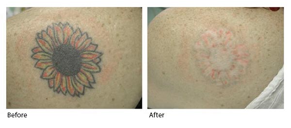 tattoo a villain during immigration 