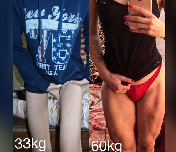 from anorexic to gym trainer