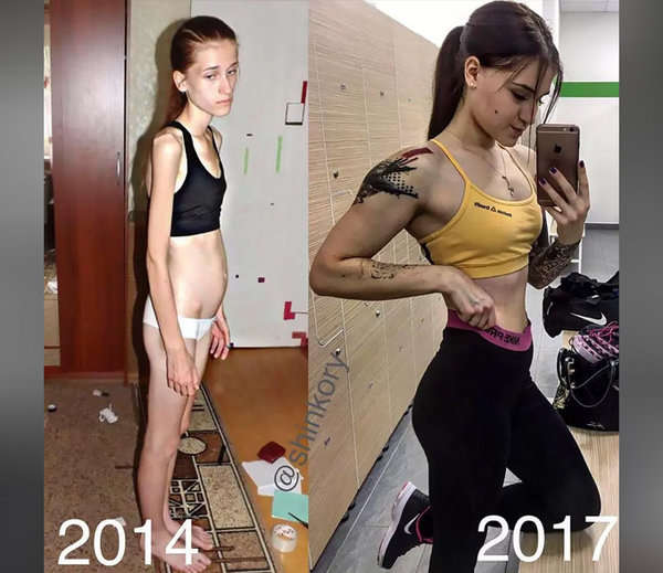 from anorexic to gym trainer