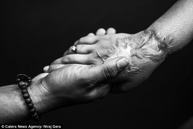 love story of acid attack victim pramodini