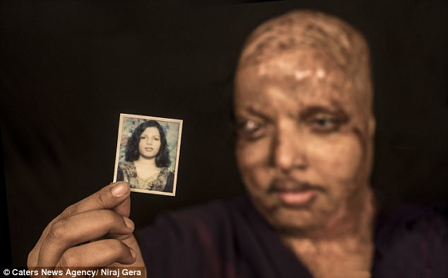 love story of acid attack victim pramodini