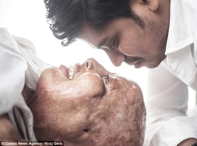love story of acid attack victim pramodini