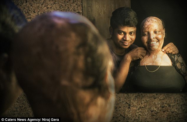 love story of acid attack victim pramodini