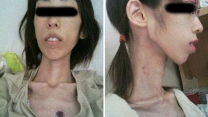 woman starved and abused by grandfather 