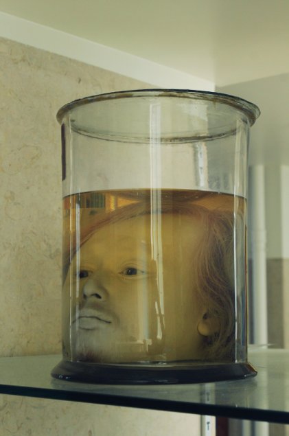 This Human Head Has Been Preserved At A University Since 1841
