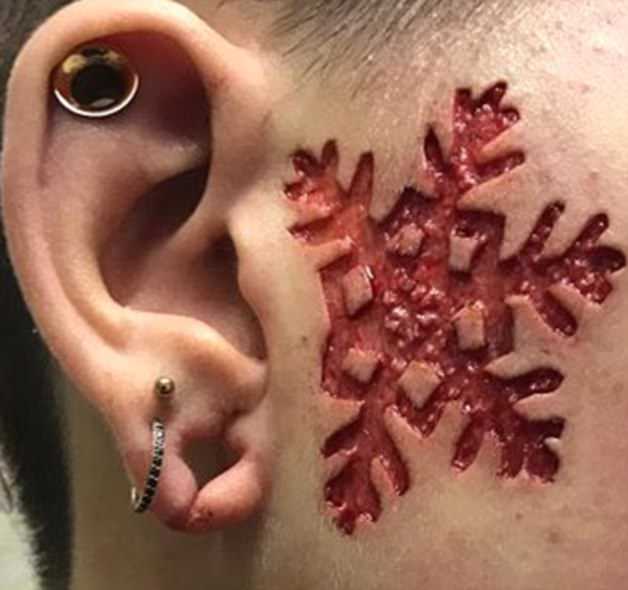 Tattooist arrested over genital mutilation 