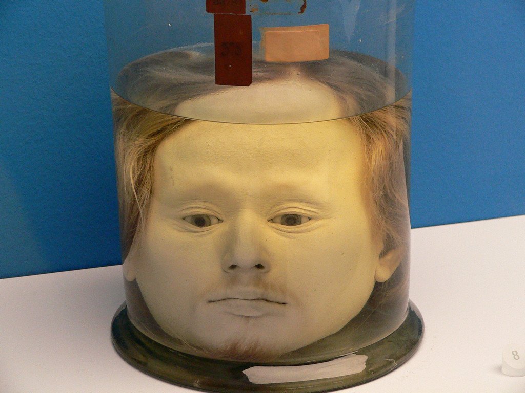 This Human Head Has Been Preserved At A University Since 1841
