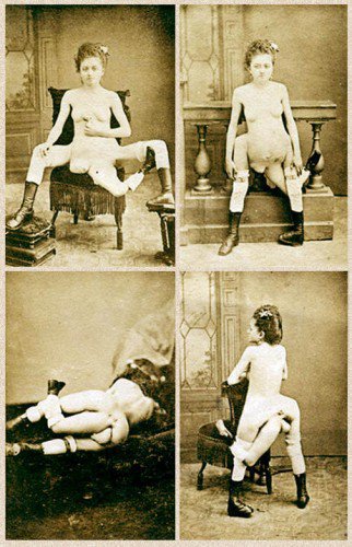the story of a girl with 3 legs and 4 breasts 