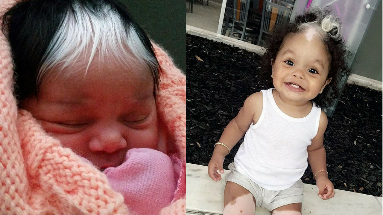 baby born with white hairs