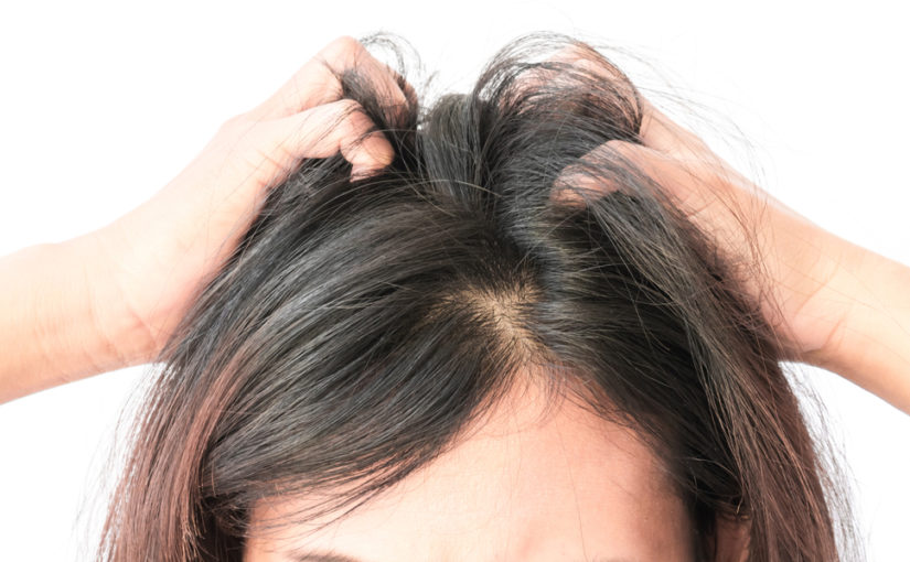 dandruff cure tips by sabitha zawariya
