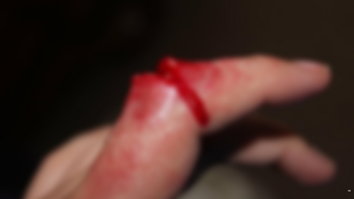 finger