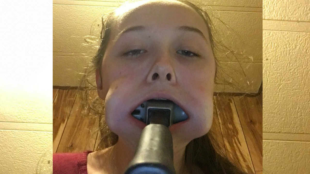 viral photo