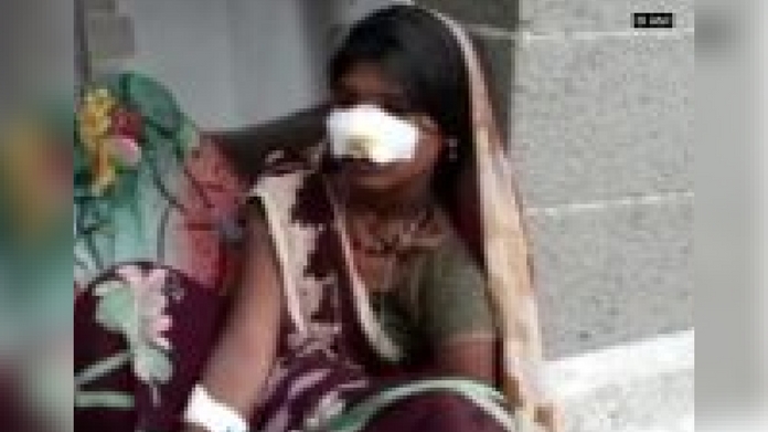 woman nose cut off