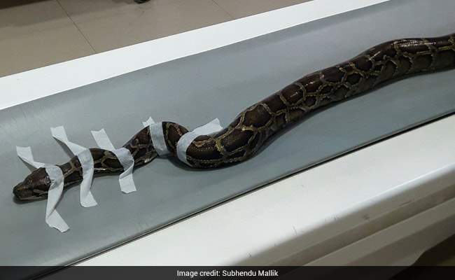 snake ct scan india