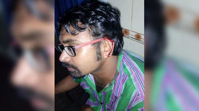 youth bite off ear at kollam