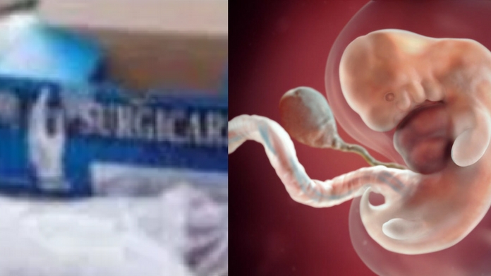 fetus