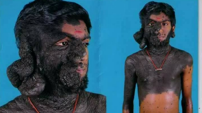 prabhulal
