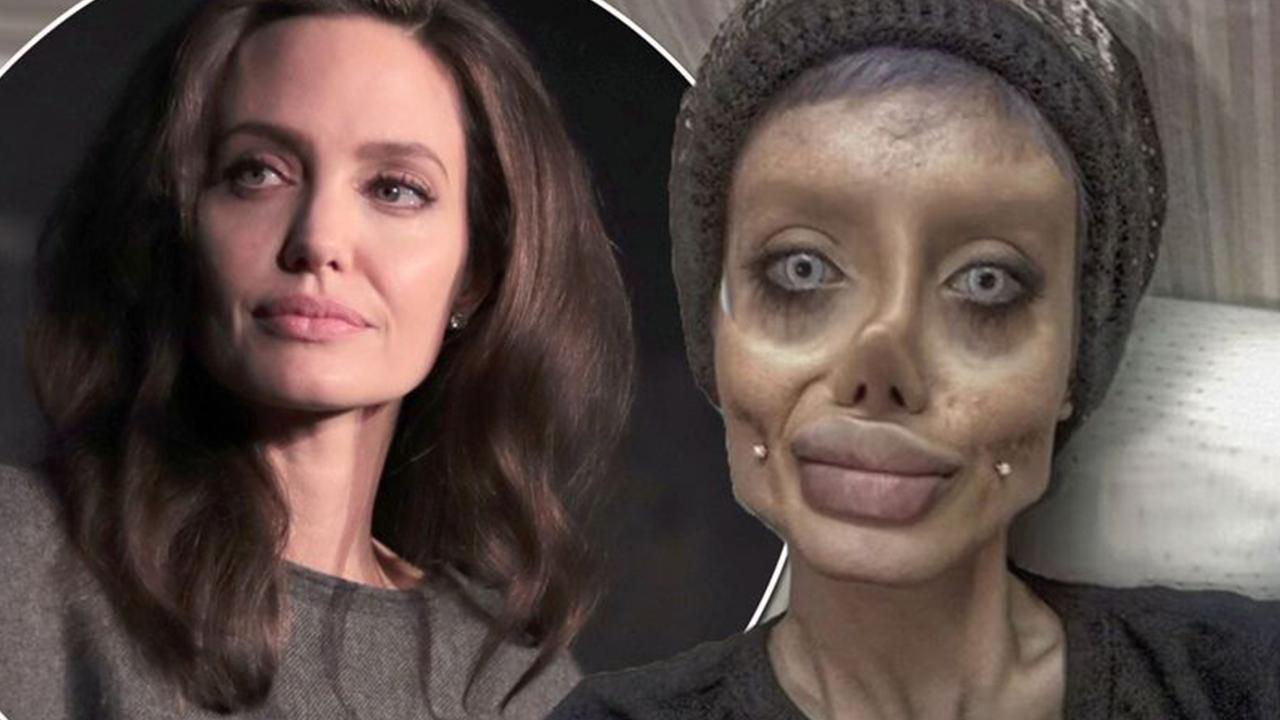 Teen’s plastic surgery to look like Angelina Jolie goes very wrong