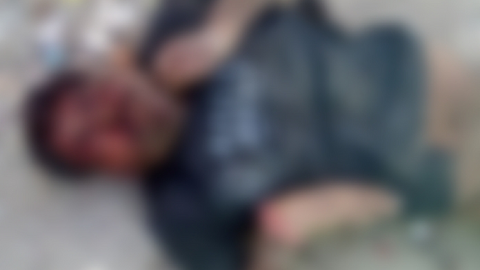 dead body