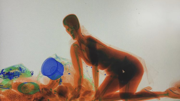 Woman climbs into x-ray machine because she didn’t want to leave her bag