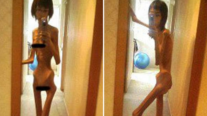woman starved and abused by grandfather