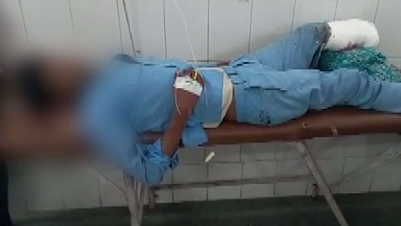 accident leg amputated