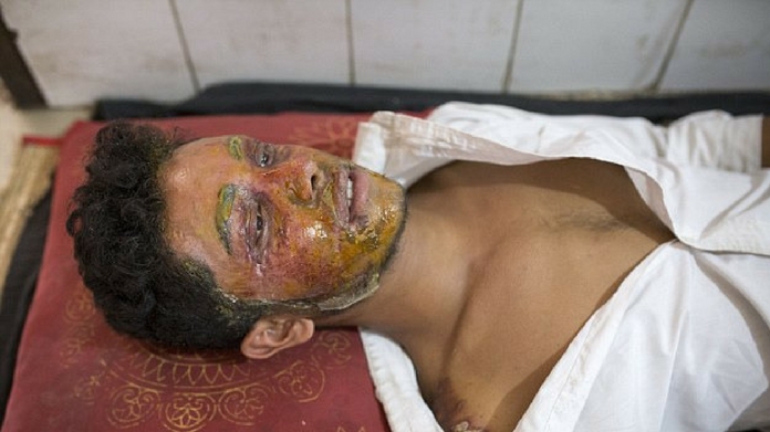 acid attack