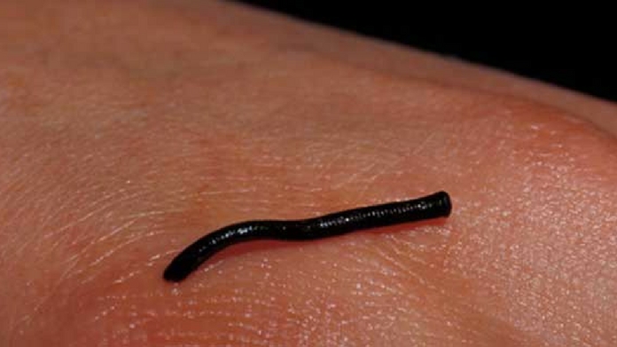 leech in nose