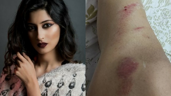 model akarshi attacked in indore