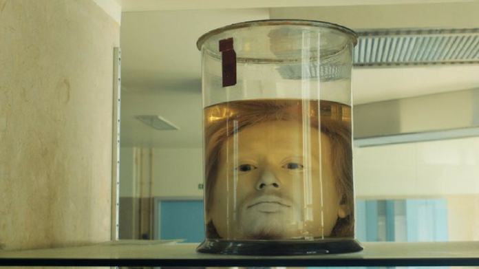 This Human Head Has Been Preserved At A University Since 1841