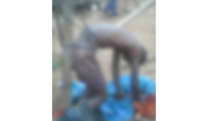 dead body