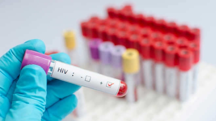 hiv