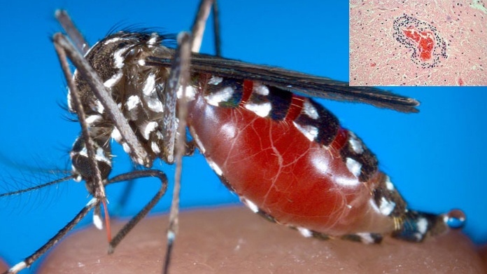 WEST NILE