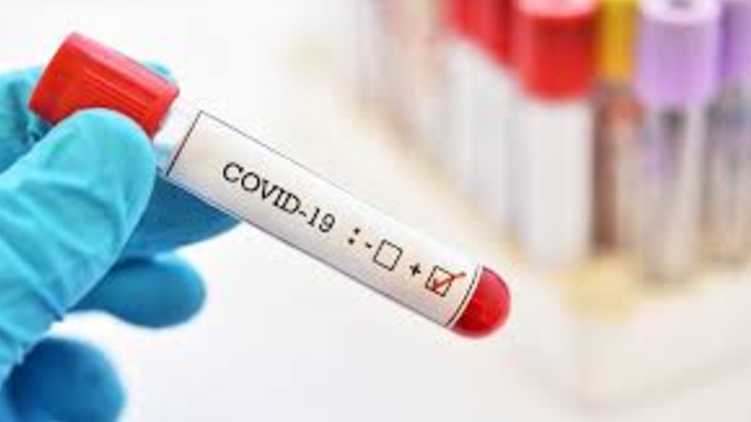 covid test