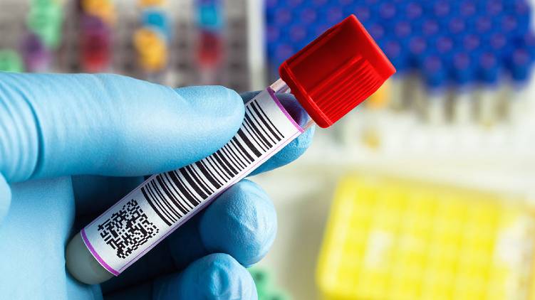 covid antibody test