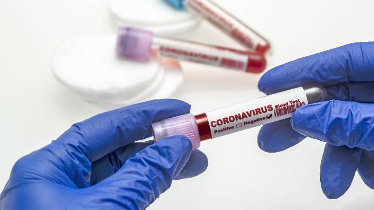 coronavirus positive test