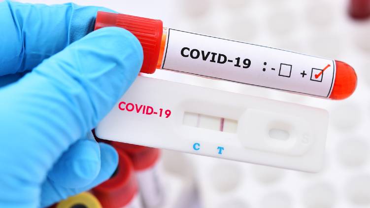 antibody test