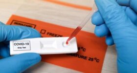 covid antibody test