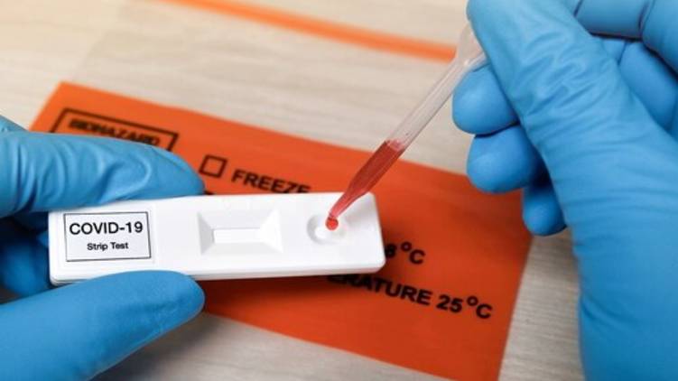 covid antibody test