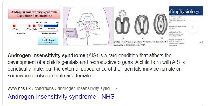 Woman 30 Discovers She is A Man Has Rare Condition