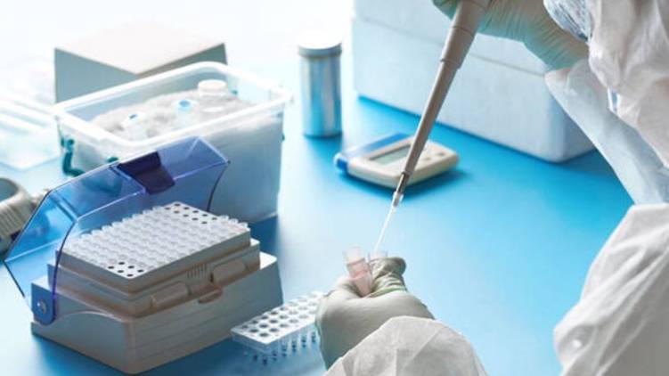 Antigen test