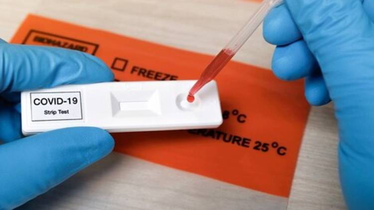 antigen test