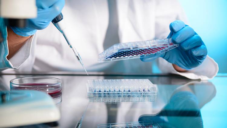 antigen test
