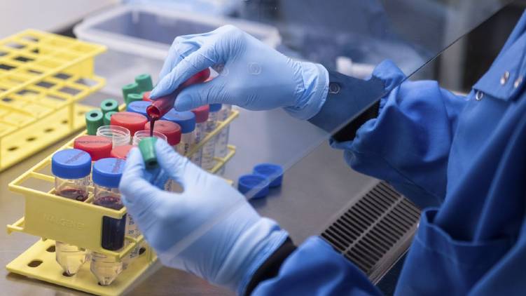 Oxford covid Vaccine