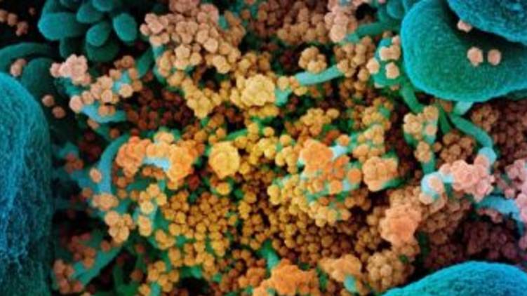 Malaysia detects new coronavirus strain D614G