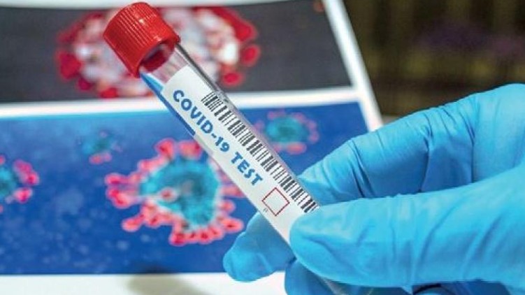128 covid cases ernakulam