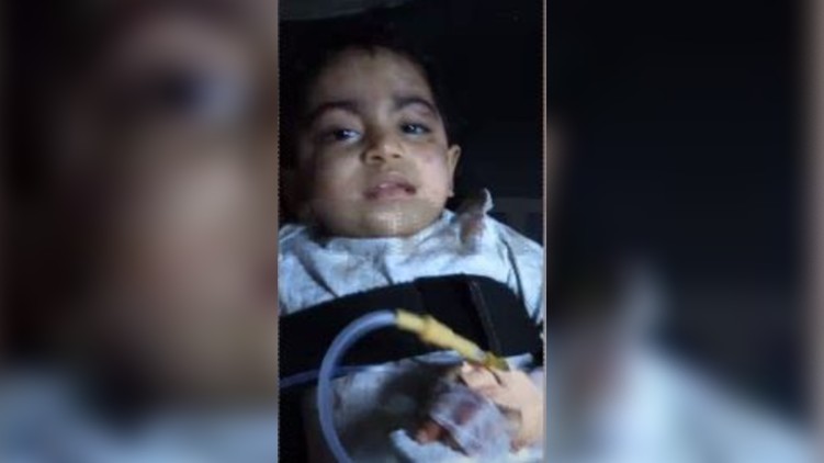 child mims hospital kozhikode