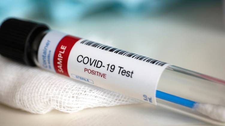 covid test