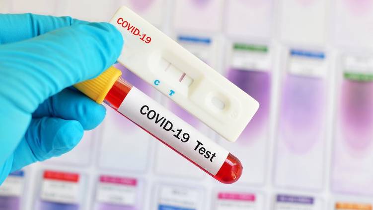 covid test