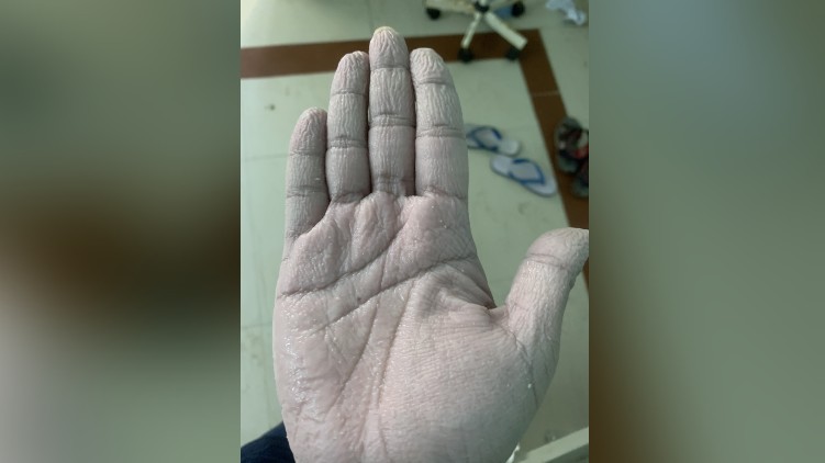 Doctor hands PPE kit